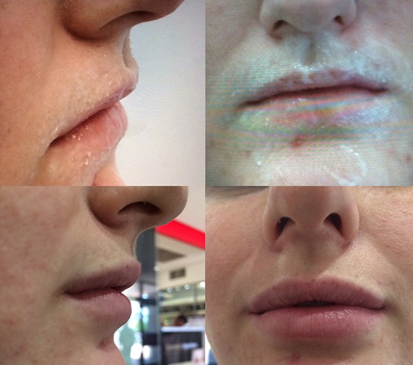 Which lip are you?